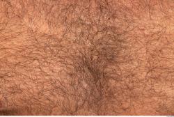 Hairy Skins